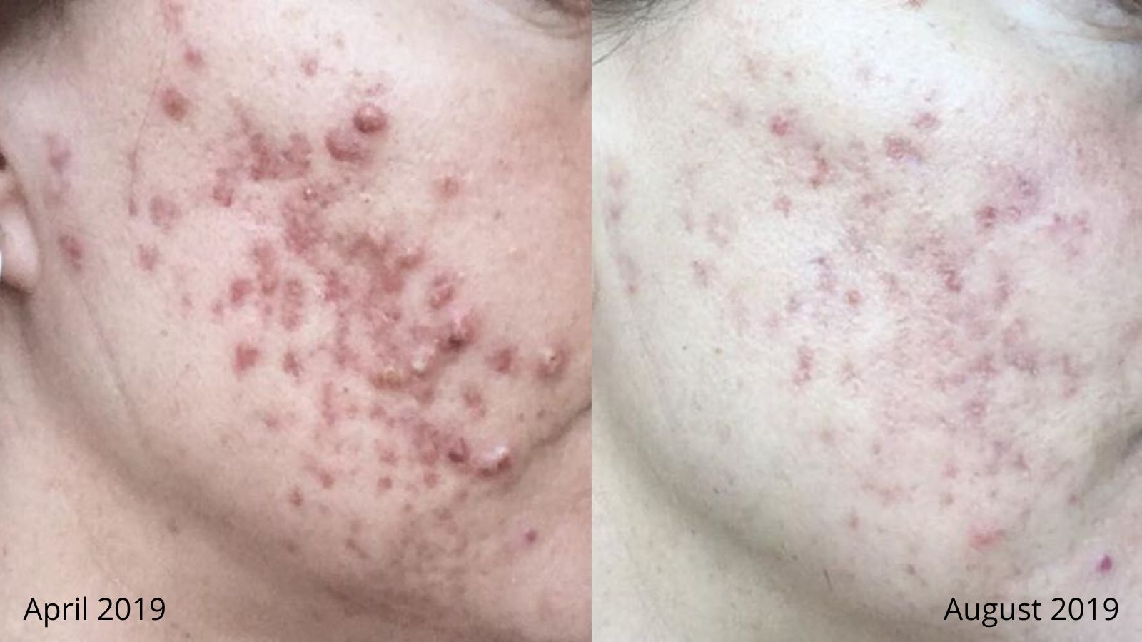 Ann Before and After Image